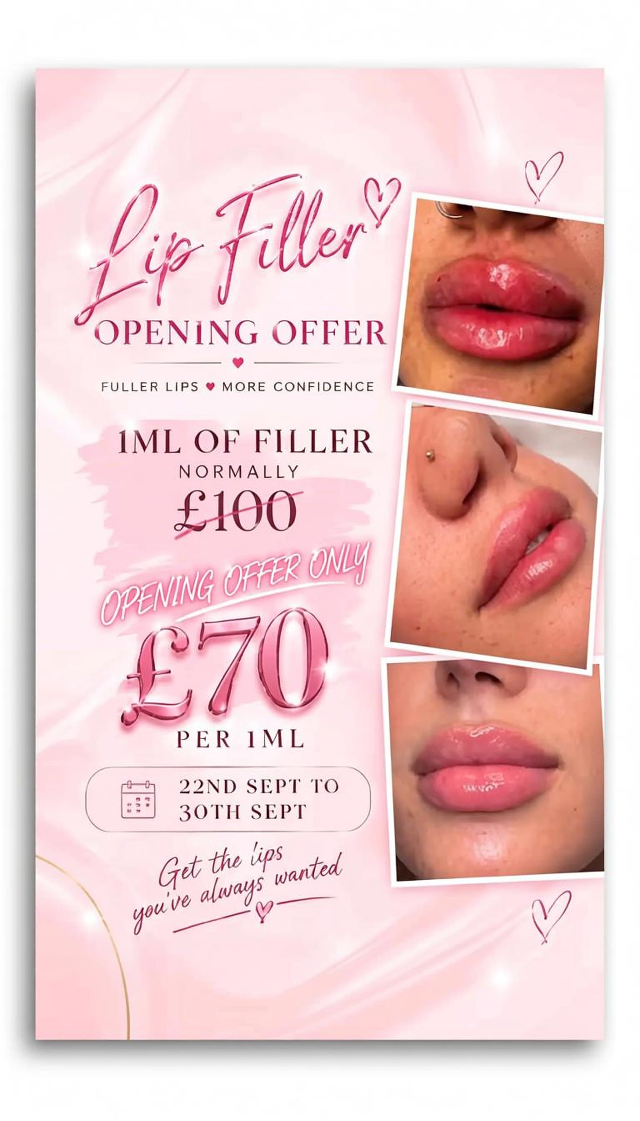 Lip Filler treatment flyer with opening offer